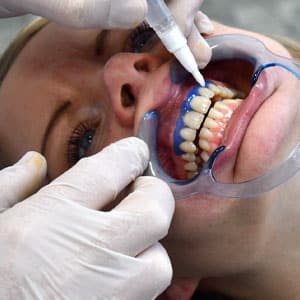 Medical teeth shade correction